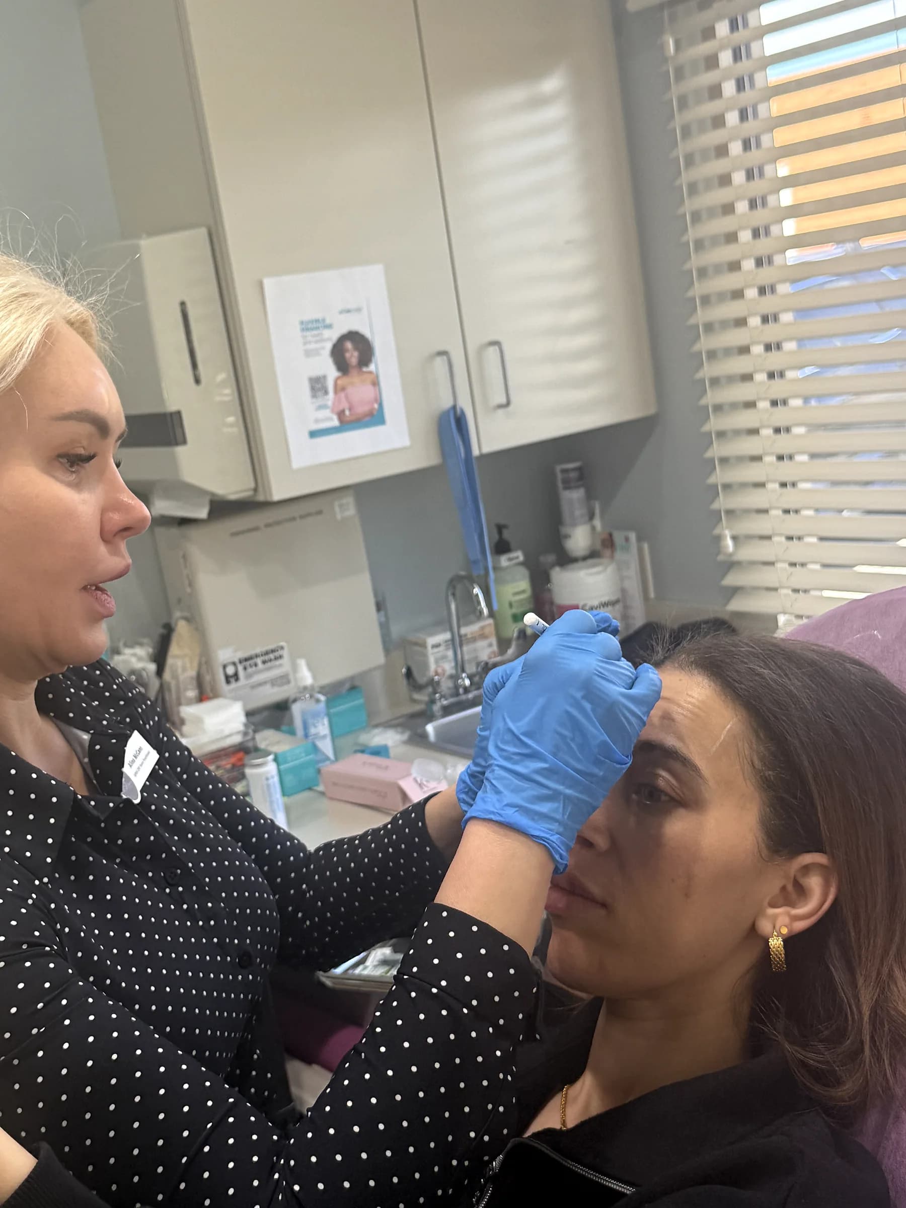 Botox being placed around the mouth