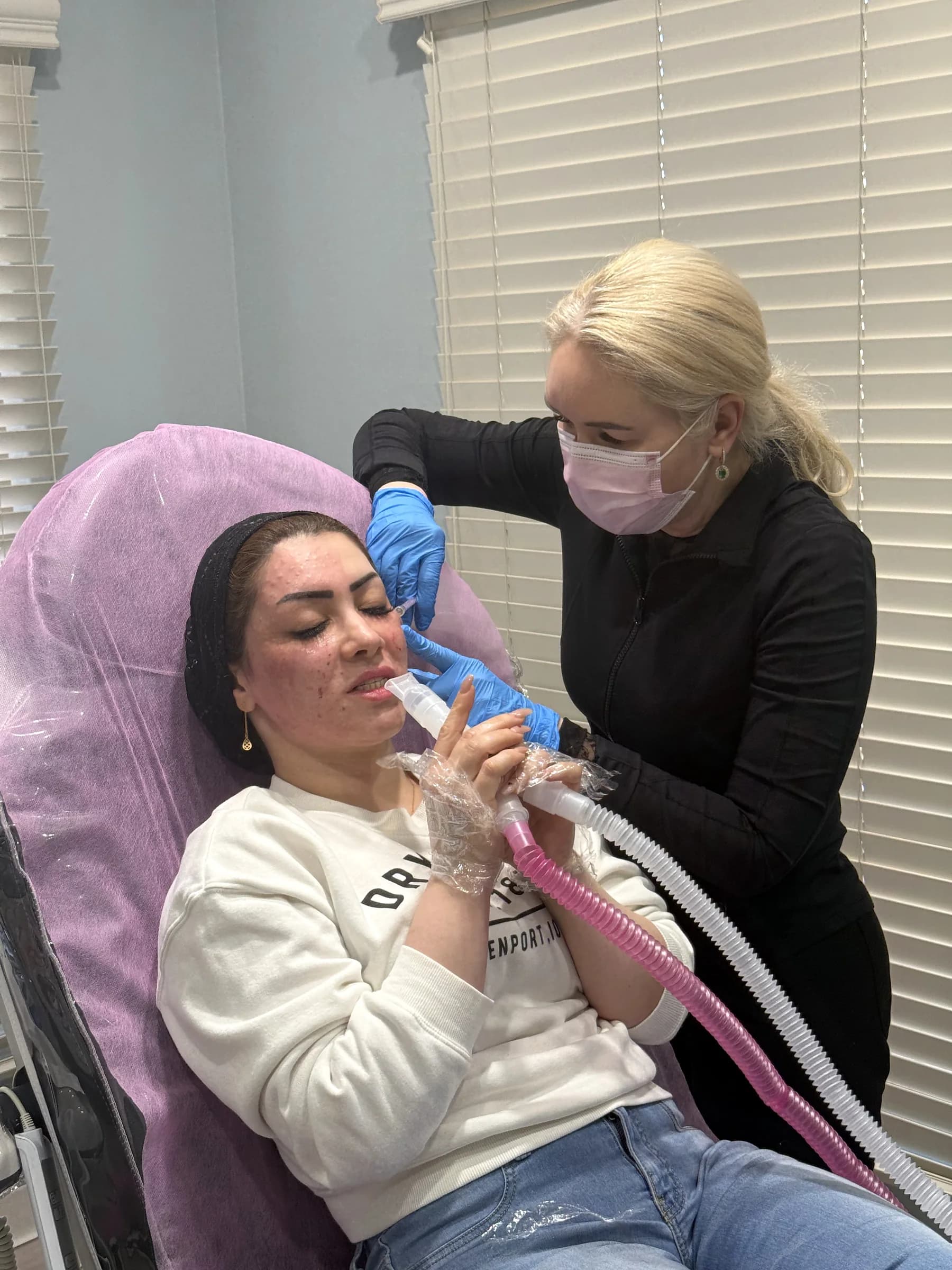 Microneedling with PRP in the treatment room