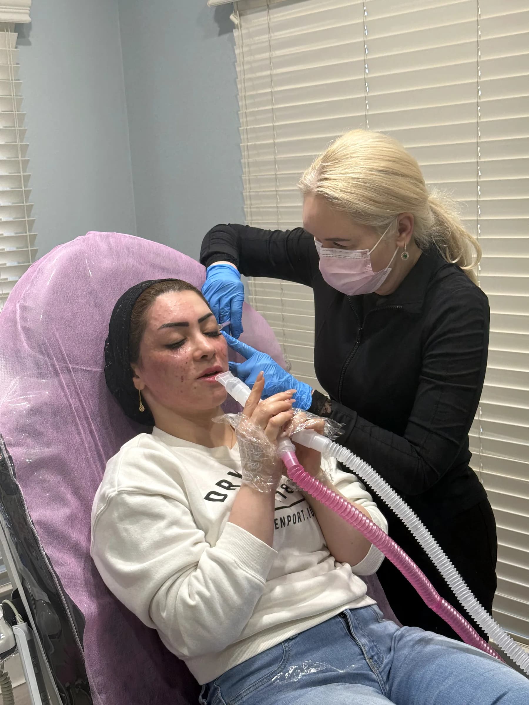 A PRP facial treatment in progress