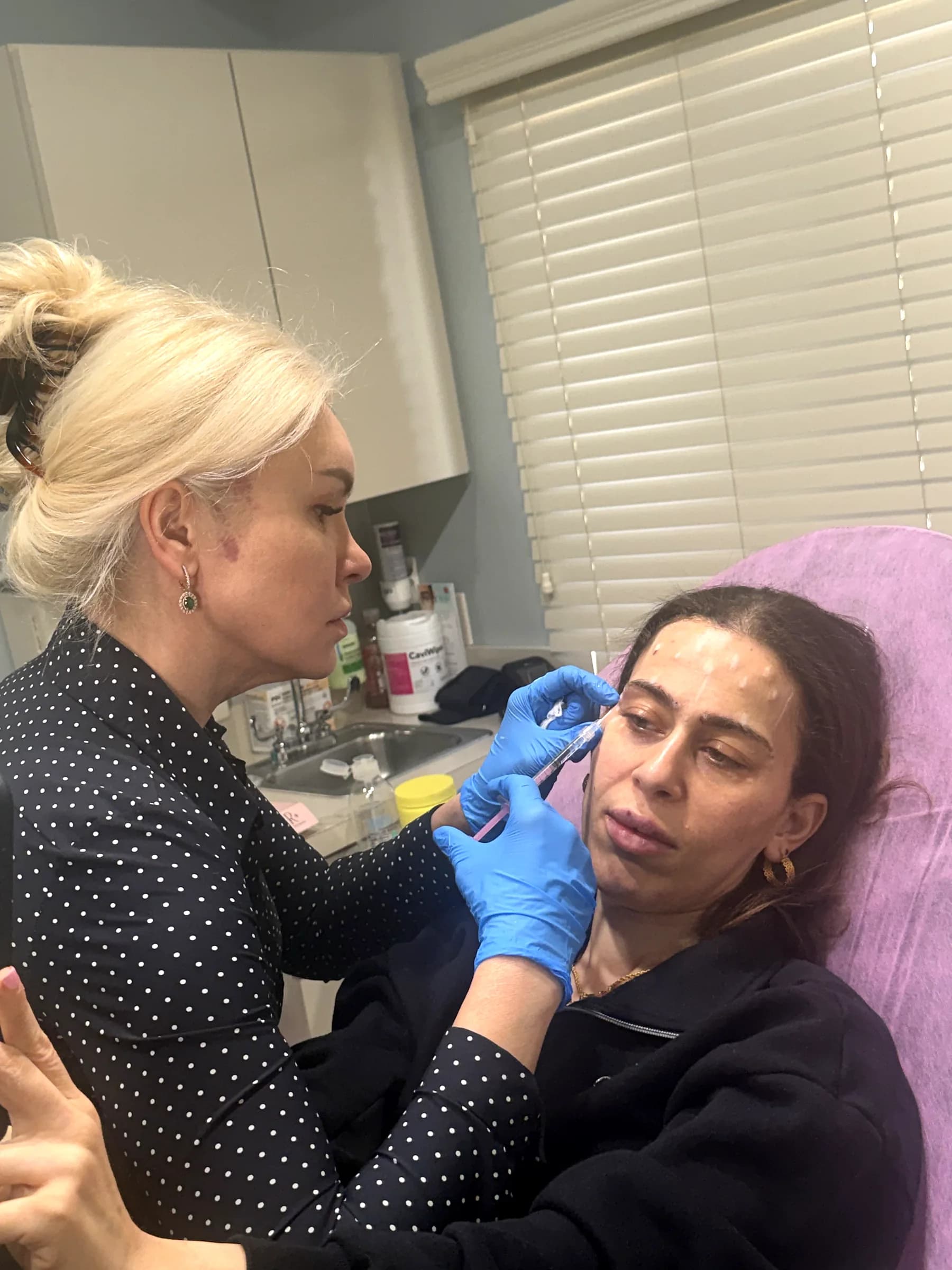 An injection placed below the eye