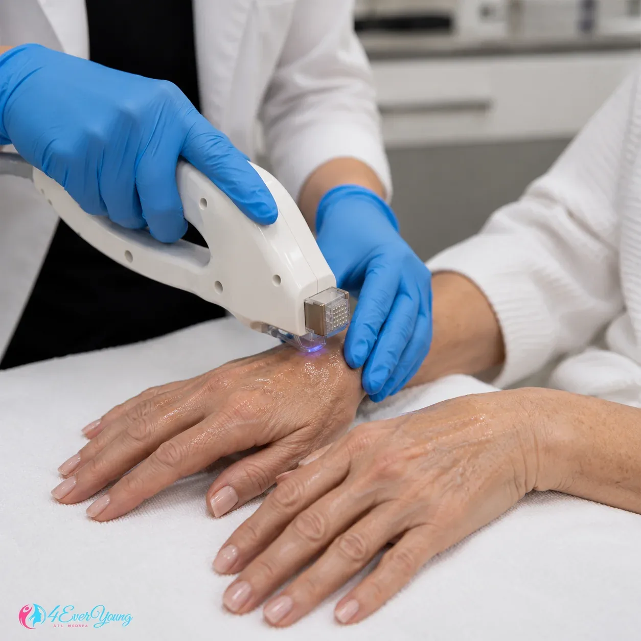 Aging Hands Treatment Creve Coeur MO
