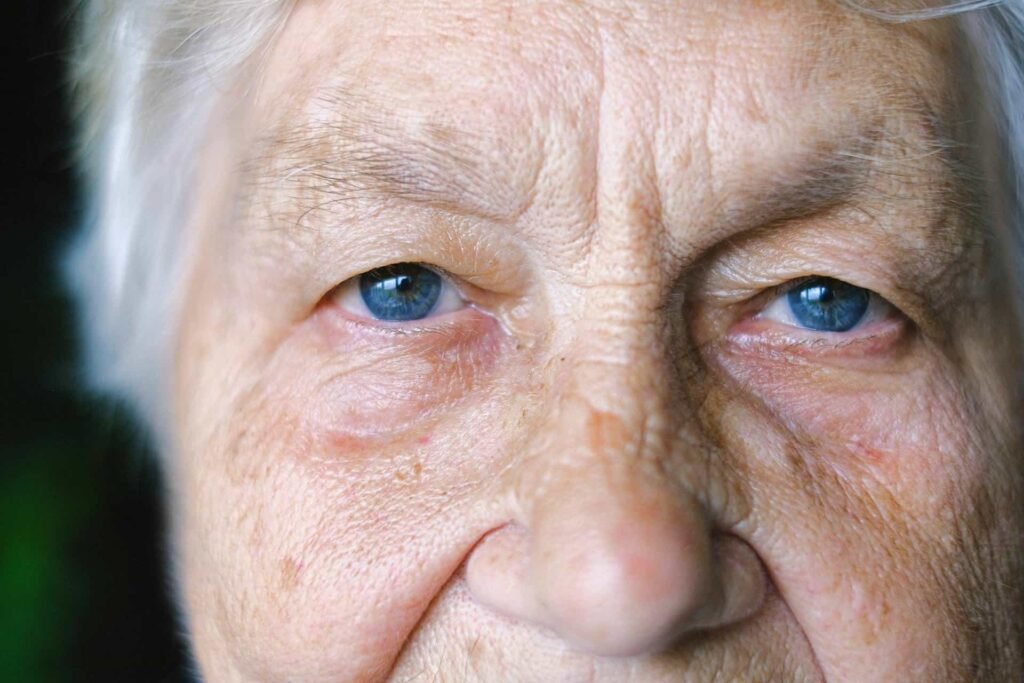 Wrinkle Relaxers in st louis