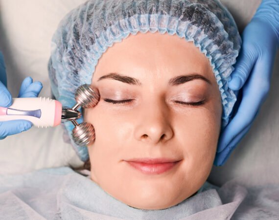 Microneedling in st louis