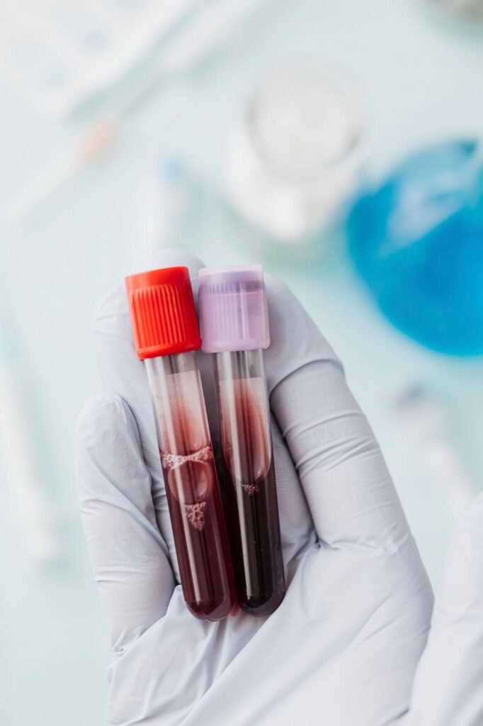 Immune System Blood Test St Louis