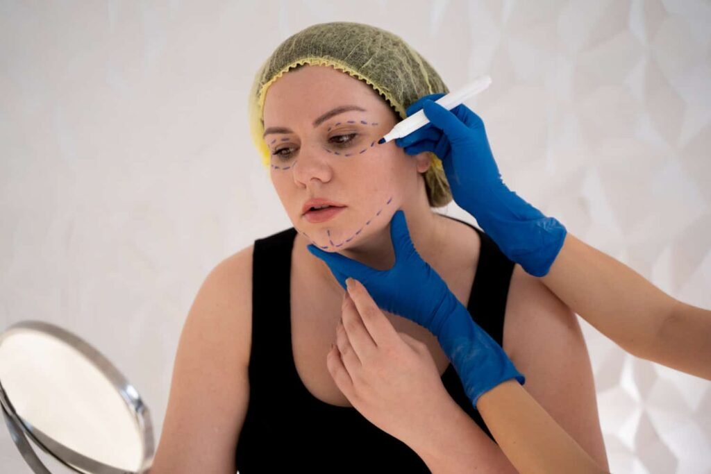 Microneedling & PRP Treatment
