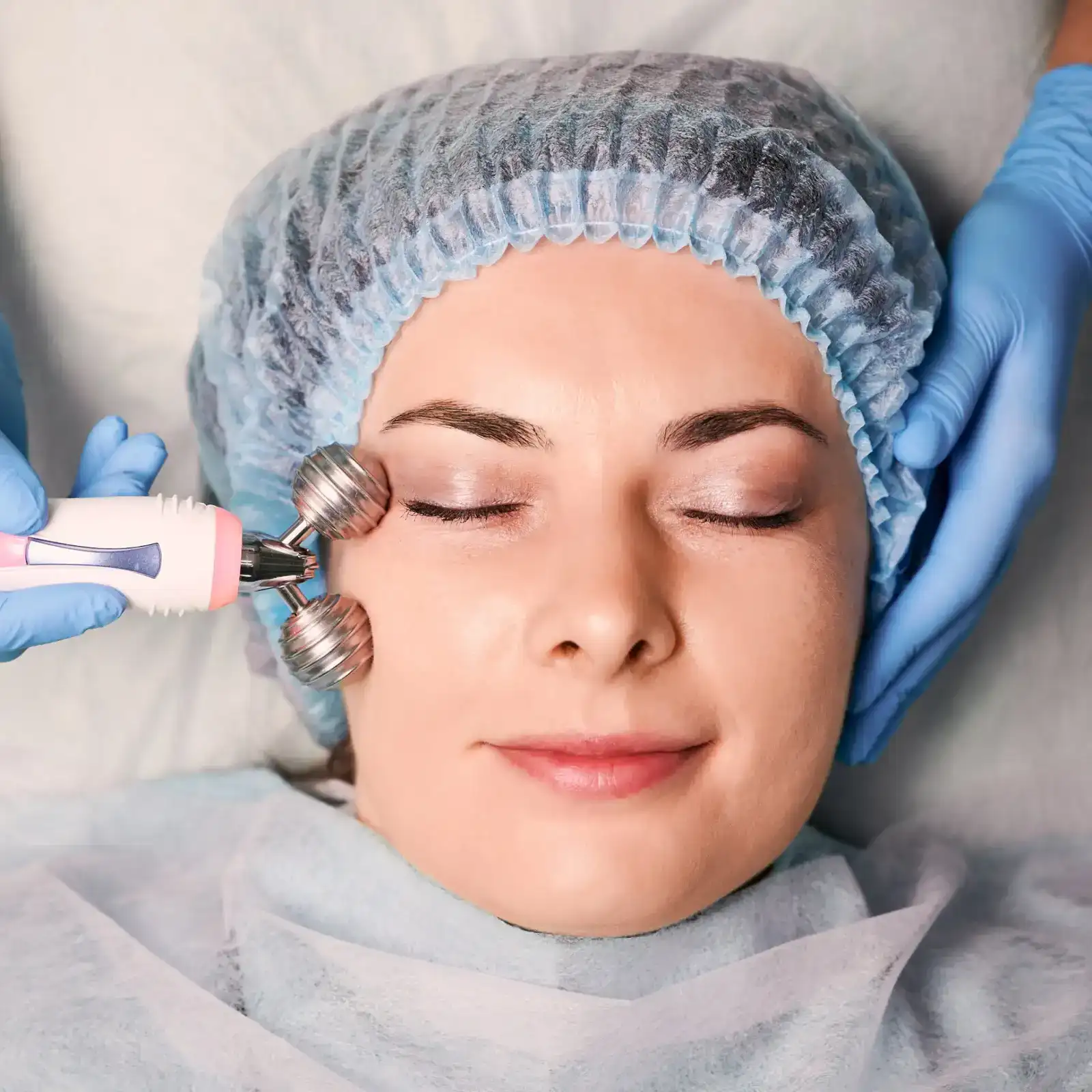 micro needling in creve couer