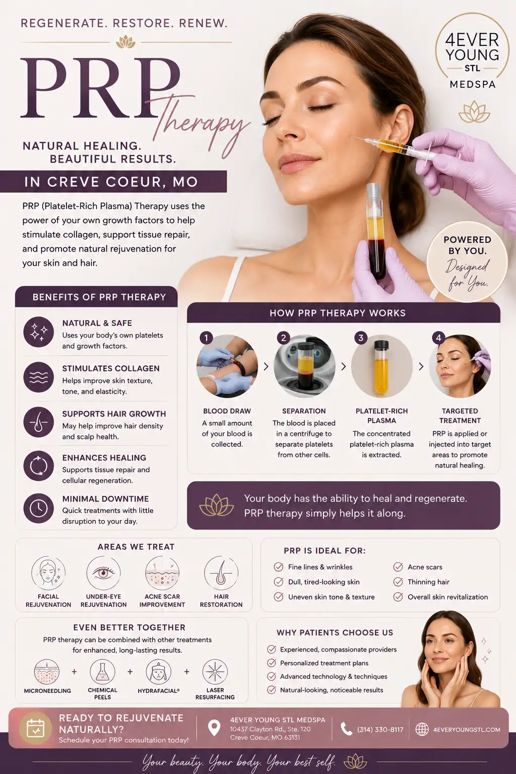 prp treatment in creve coeur