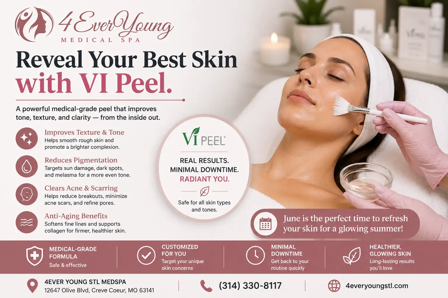 vi peel in creve couer mo
