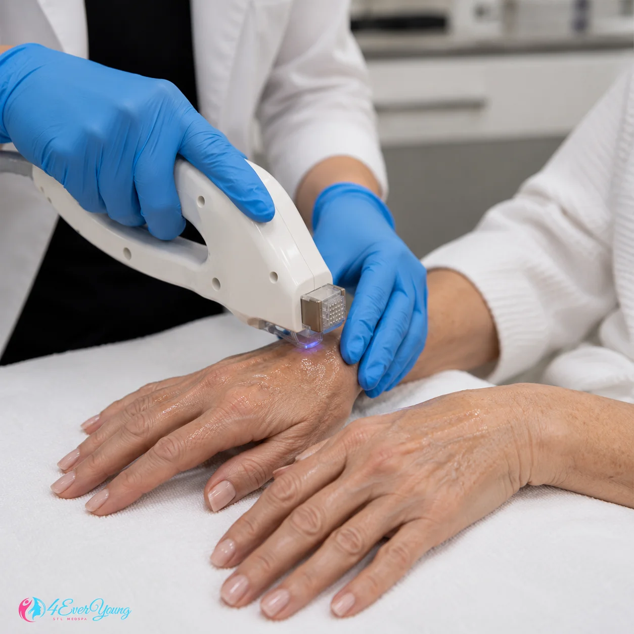 Aging Hands Treatment Creve Coeur MO