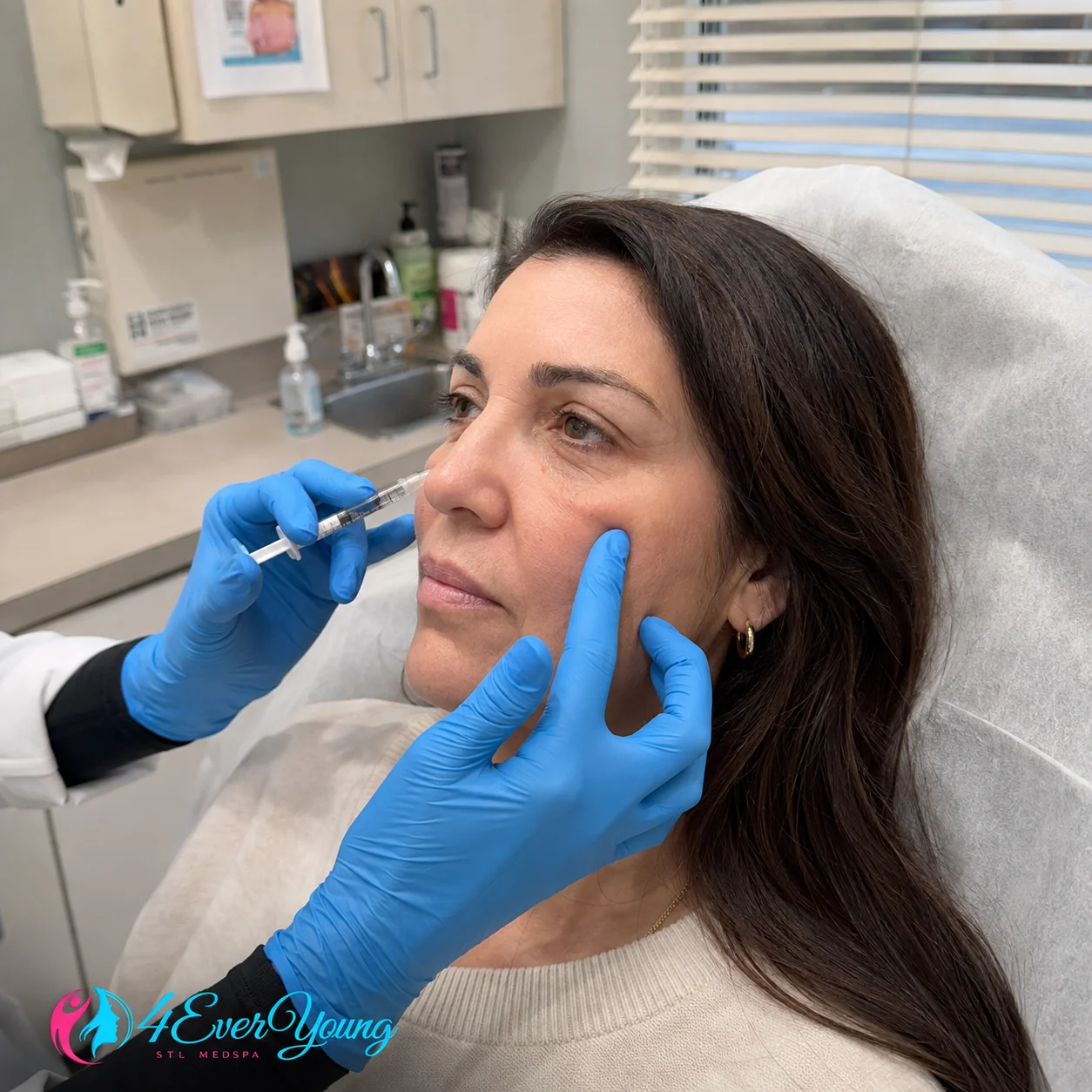 Hybrid Filler for Dark Circles Under Eyes Creve Coeur MO