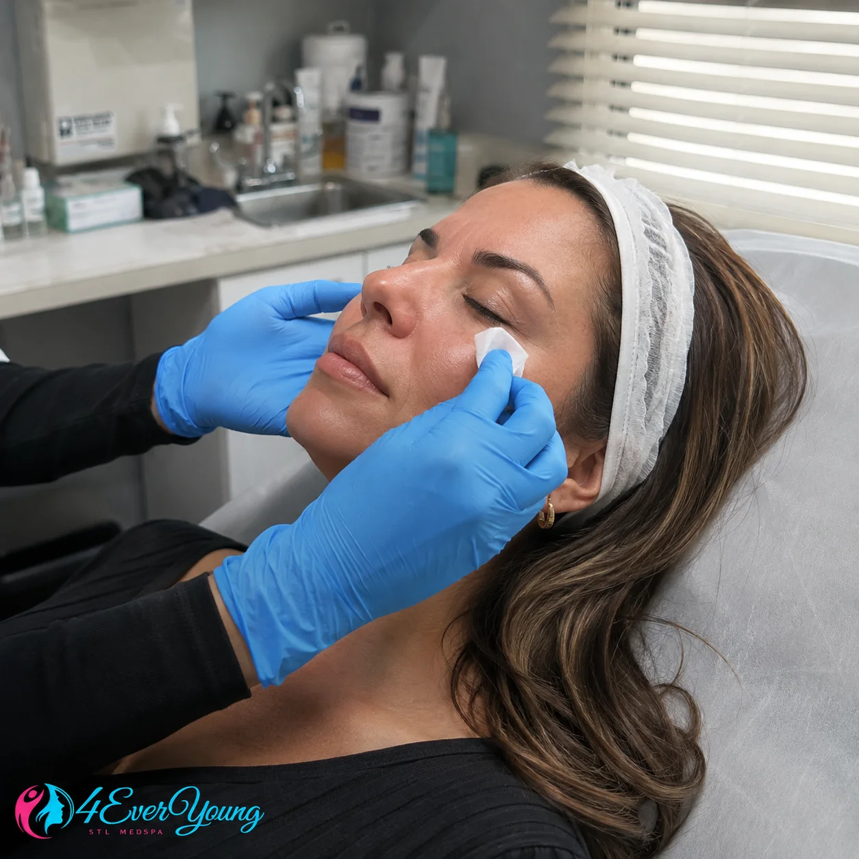 Microneedling for Crepey Under Eye Skin Creve Coeur MO