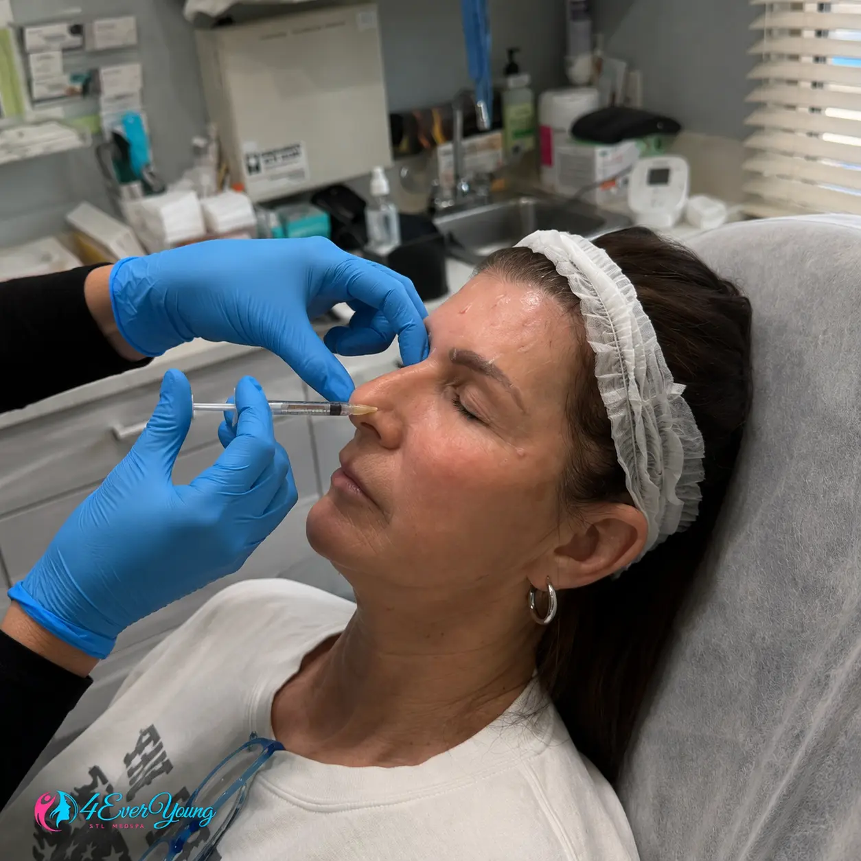 Nasal Bumps or Deviations 2 Non Surgical Nose Filler for Nasal Bumps Creve Coeur MO