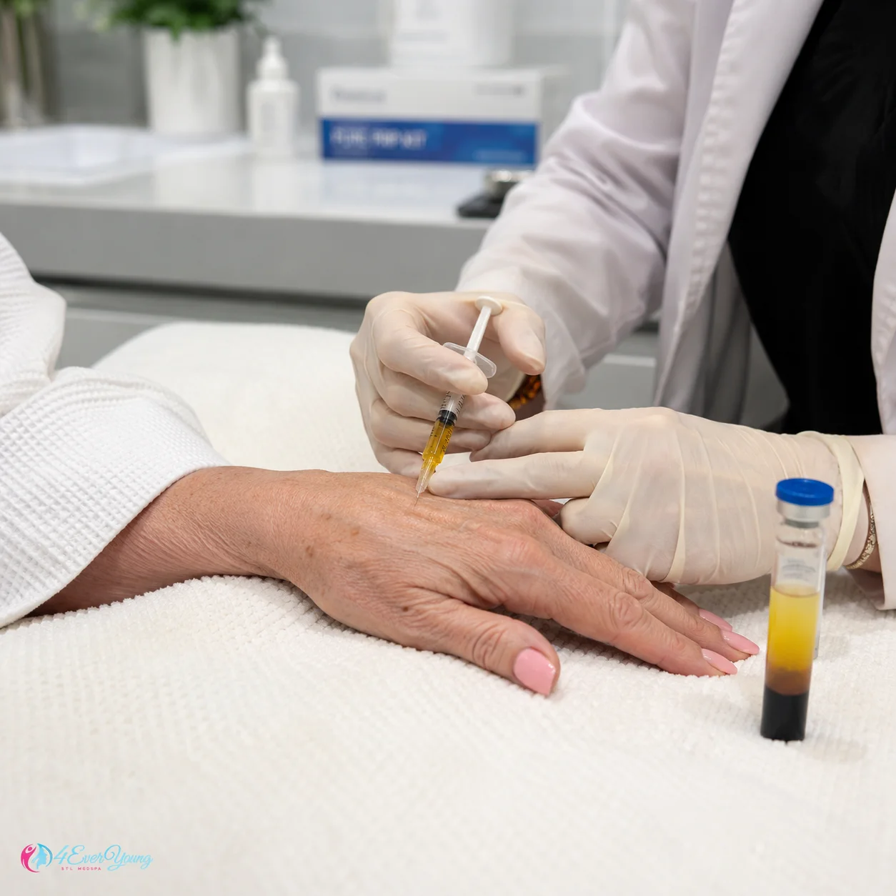 PRP Exosomes Hand Rejuvenation Creve Coeur MO