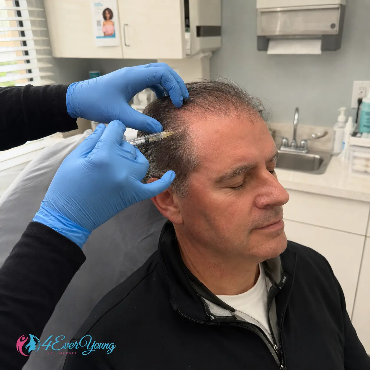 PRP Hair Restoration for Premature Hair Loss Creve Coeur MO