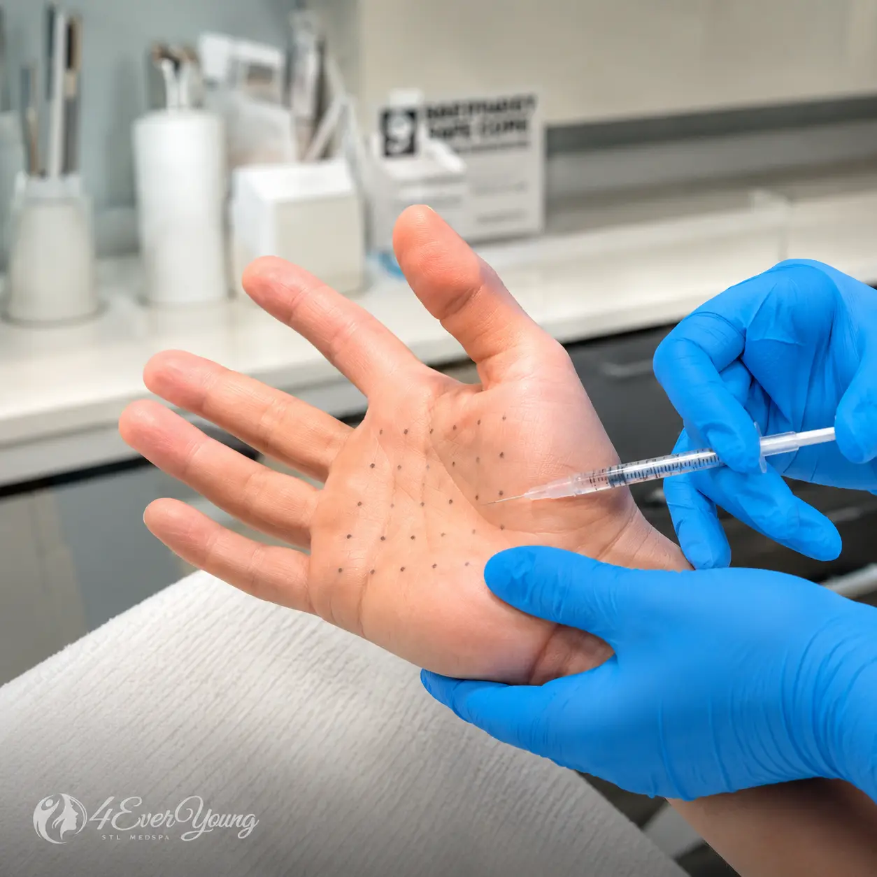 Sweaty Palms Hyperhidrosis Hand Assessment Creve Coeur MO