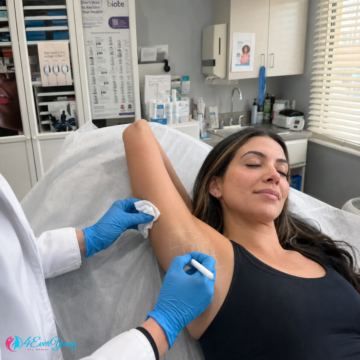 Underarm Hyperhidrosis Treatment Mapping Creve Coeur MO