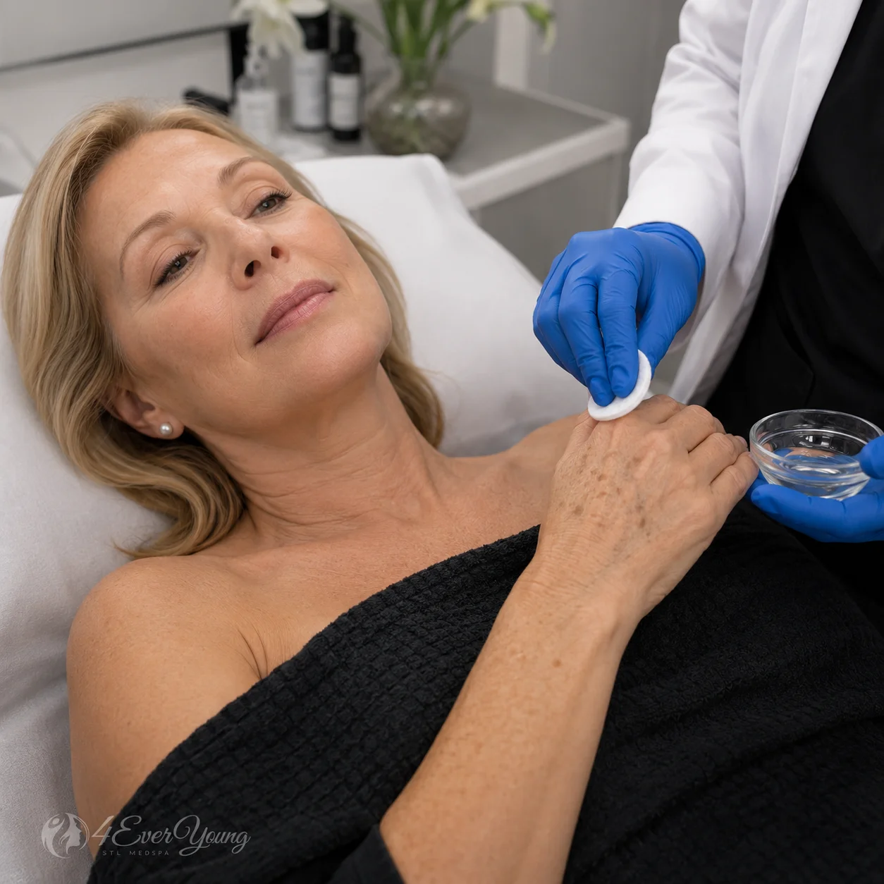 VI Peel for Age Spots and Sun Damage Creve Coeur MO