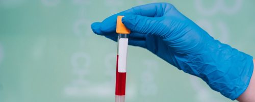 Anemia Test