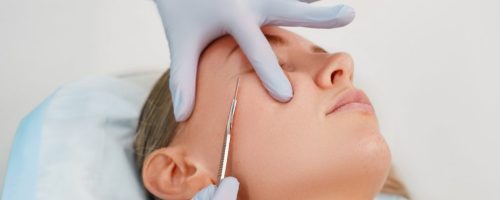 Dermaplaning in creve coeur, 4Ever Young STL MedSpa