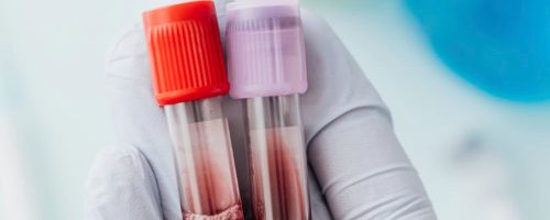 Immune System Blood Test St Louis