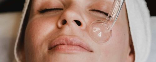 Vi Peel & Dermaplaning Treatment