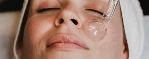 vi peel and dermaplaning treatment in st louis
