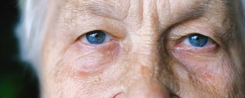 Wrinkle Relaxers in st louis