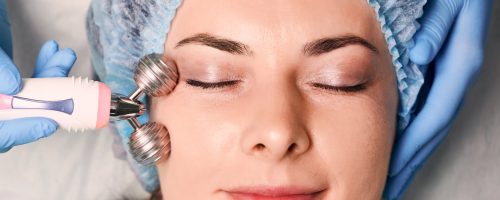 Microneedling