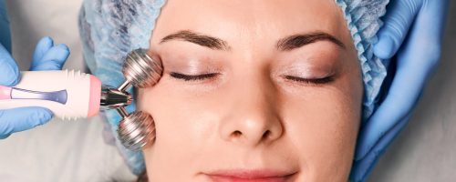 Microneedling in st louis